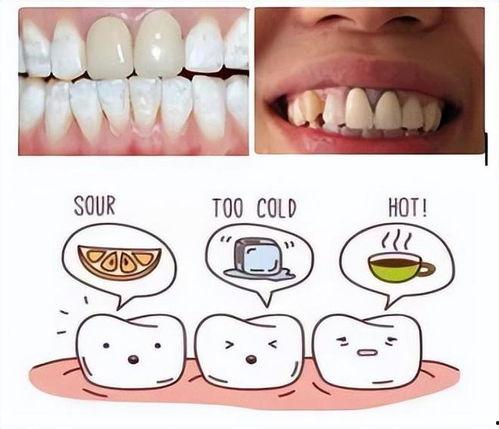 烤瓷牙视频,视频带你了解每一环节